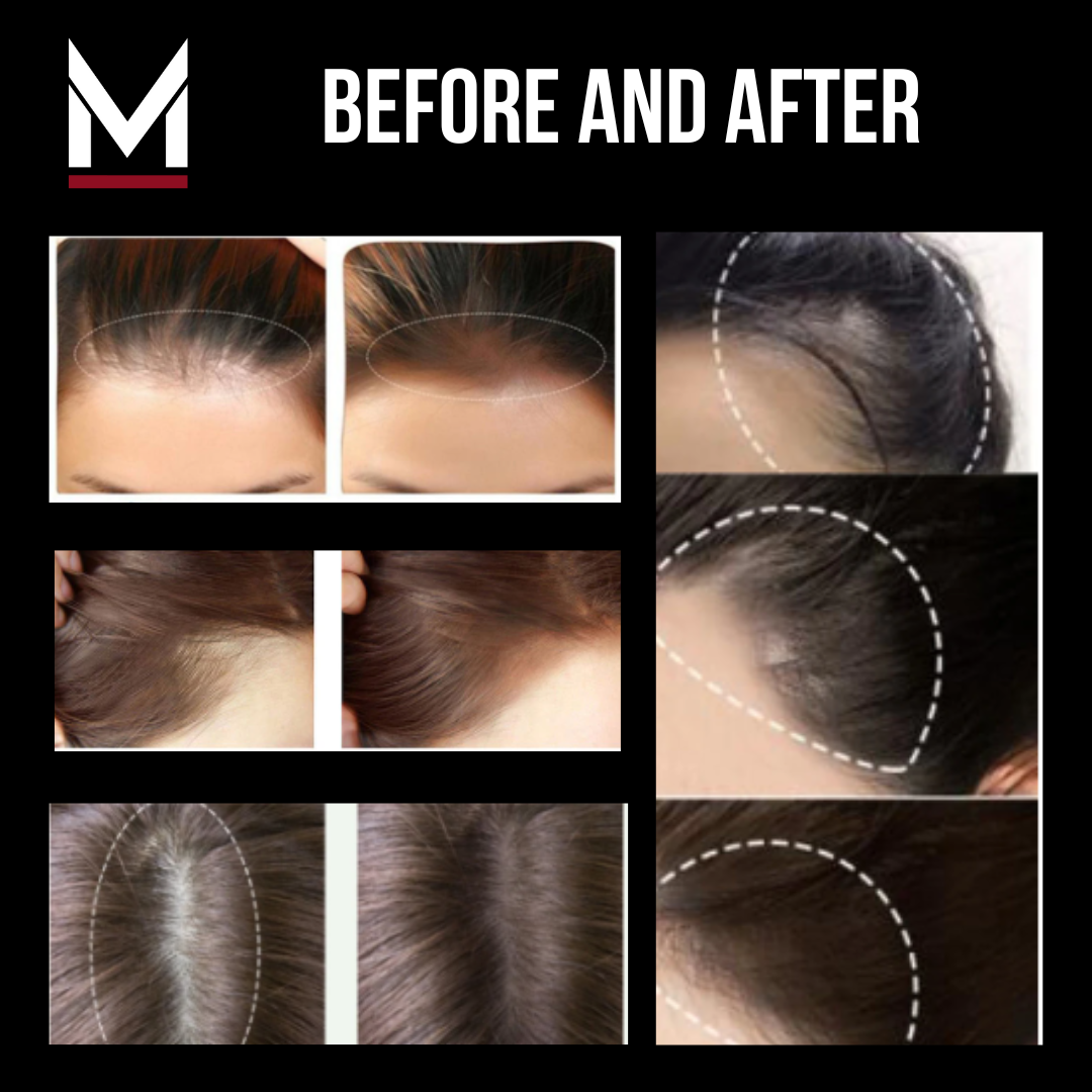 Snatched - Instant Hair Filler